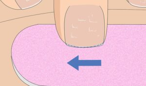 How to Prevent Nail Breakage and Peeling Effortlessly